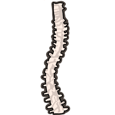 a human spine that curves in an 's' shape.