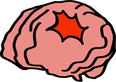 A brain with a red, spiky 'impact' shape in it.