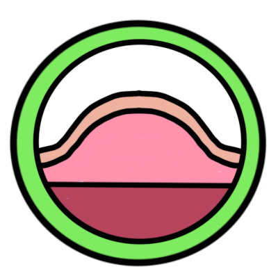 A green circle with another circle inside it. in this circle is a simplified cross-section of a pink tumor below beige skin