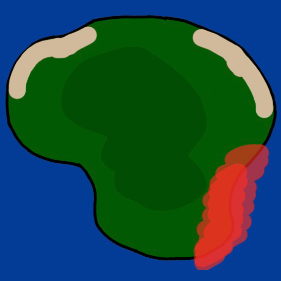A drawing of an island in the middle of the ocean. The island has two beaches on the upper section of the island one beach to the left and one on the right There is a forest that is dark green in the middle of the island On a small section of the lower right section of the island a red blob that covers a small section of the island.