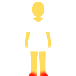 A person with no hair or face, an emoji yellow skintown, and a white pair of shorts and pants with no visible divider between the two. there are glowing red spots on their feet.
