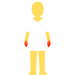 A person with no hair or face, an emoji yellow skintown, and a white pair of shorts and pants with no visible divider between the two. there are glowing red spots on their hands.