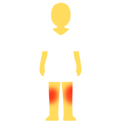 A person with no hair or face, an emoji yellow skintown, and a white pair of shorts and pants with no visible divider between the two. there are glowing red spots on their knees.